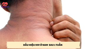 dấu hiệu hiv ở nam sau 1 tuần