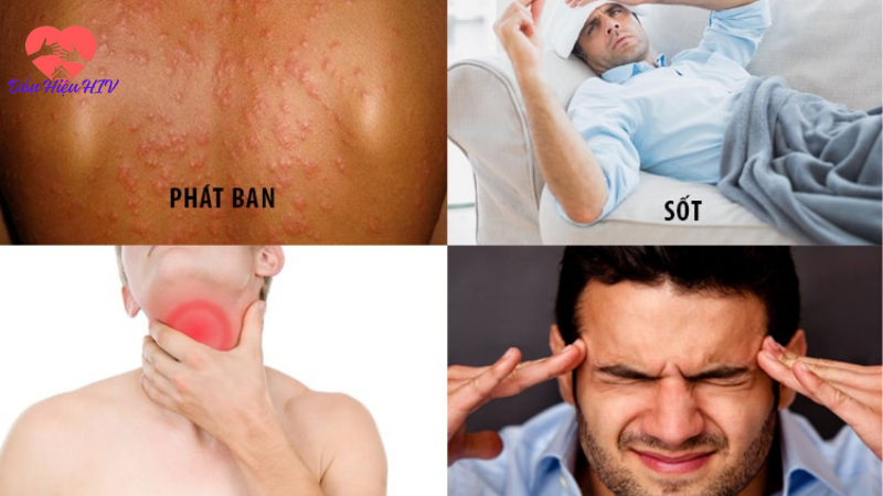 dấu hiệu nhiễm hiv sau 4 tháng