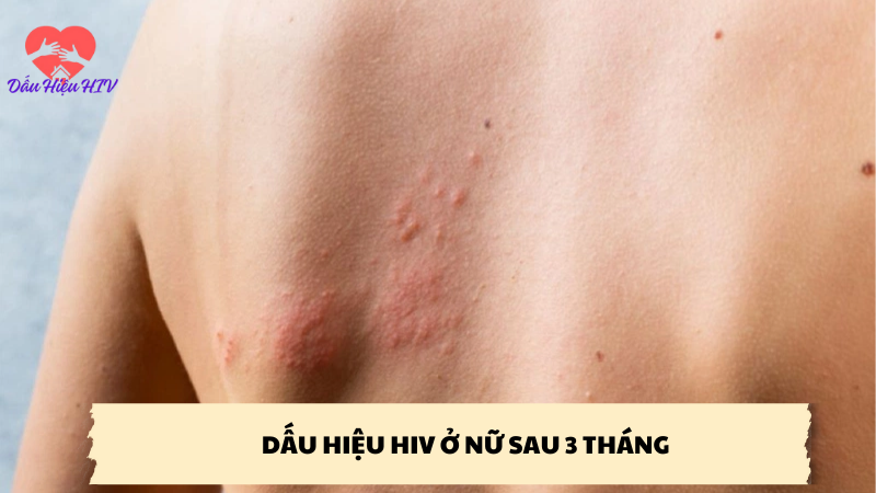 dấu hiệu hiv ở nữ sau 3 tháng