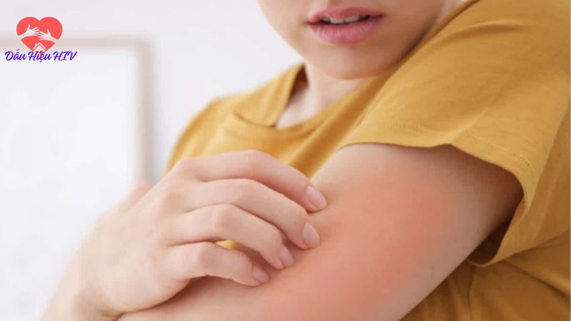 Dấu hiệu hiv 1 tháng