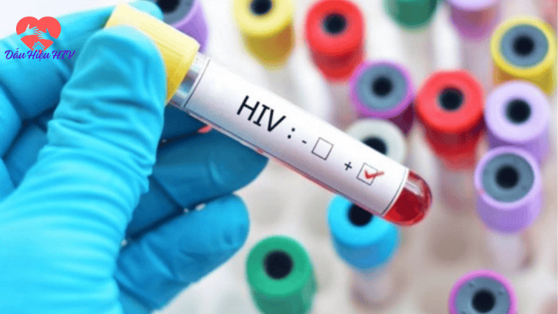 Dấu hiệu hiv 1 tháng
